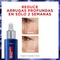 Serum Retinol L´Oréal Paris Revitalift  30 ML