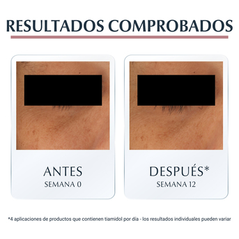 Contorno de Ojos Eucerin Anti-Pigment Anti-ojeras 15ml