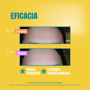 Crema Gel Hidratante Control Acné Dermaglós 50 g