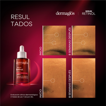 Serum Facial Dermaglós Retinol 25 ml