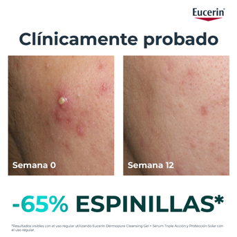 Serum Triple Efecto Eucerin DermoPURE Oil Control 40 ml