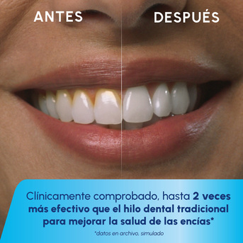 Irrigador Inalambrico Waterpik  Cordless Plus Blanco