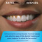 Irrigador Inalambrico Waterpik  Cordless Plus Blanco